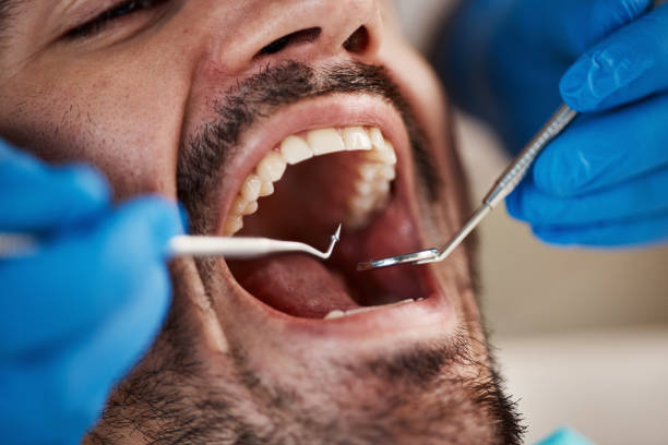 Best Emergency Tooth Extraction in Magnolia, NC